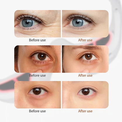 ReGlow Eye Therapy